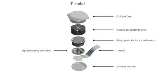 Exploded view of the Neuralink N1 implant